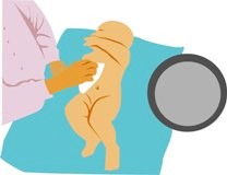Ombilicul nou nascutului si pansamentul ombilicului